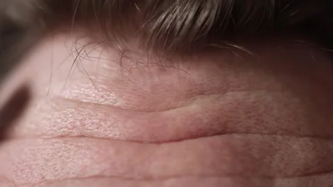 Closeup of forehead skin texture with pores Stock Footage 329586241