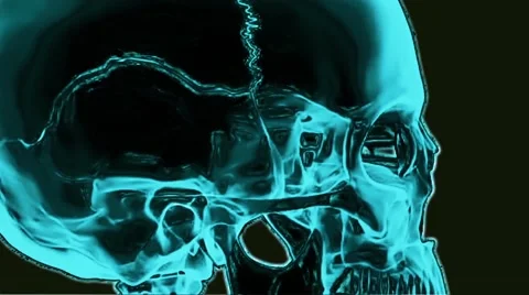 Closeup Glitchy Blue X-Ray Skull Stock Footage