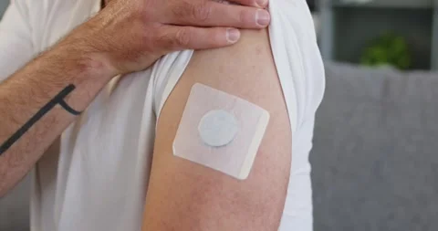 Closeup of glucose sensor patch on mans ... | Stock Video | Pond5