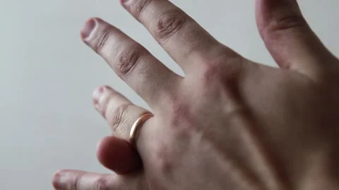 Closeup Of Hands. The Man Takes Off His Wedding Ring Stock Footage 134289027