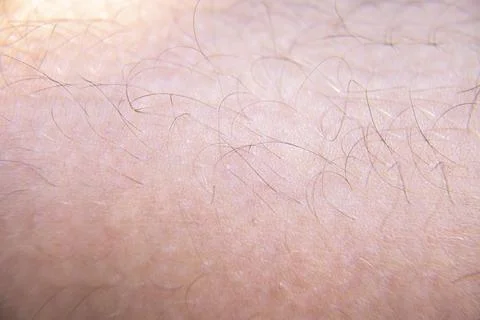 Closeup human skin, background texture Stock Photos