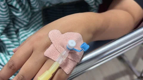 Closeup of iv cannula inserted into a vein 스톡 동영상 313913380