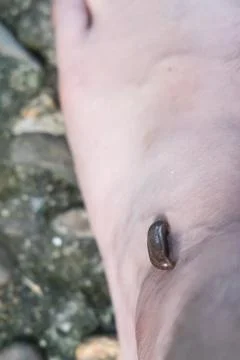 Closeup on leech attach biting on leg in tropical forrest Foto stock