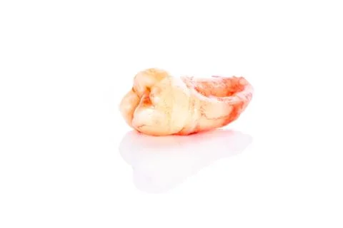 A closeup left upper third molar after extraction (Adult tooth number 28) Stock Photos
