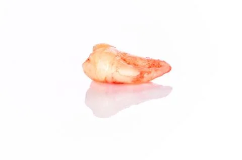 A closeup left upper third molar after extraction (Adult tooth number 28) Foto stock