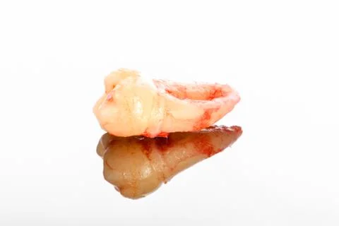 A closeup left upper third molar after extraction (Adult tooth number 28) Stock Photos