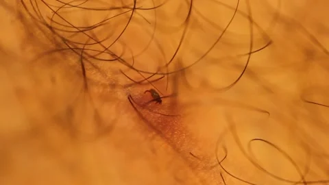 Closeup macro moving mite insect on the surface Stock Footage 214000718