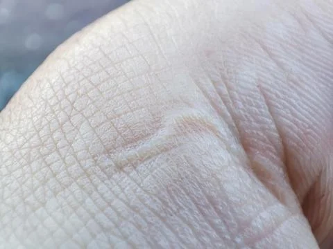 Closeup macro skin pattern. Healthy human surface. Detail hand skin. Naked .. Stock Photos