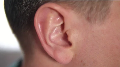 Closeup man's ear. Ear in profile Stock Footage 108774055