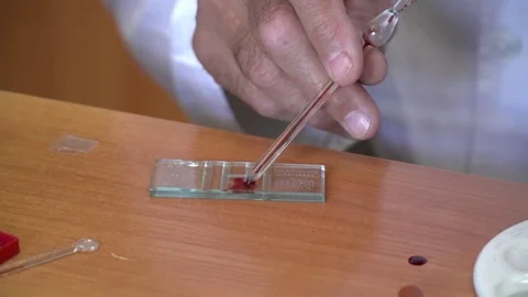 Closeup of man's hands working with the blood samples Stock Footage 76903082
