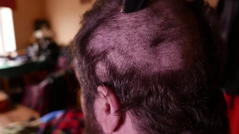 Closeup of a mans head getting trimmed. 4K UHD Stock Footage