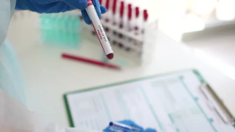 Closeup of microbiologist hand with blue surgical gloves looking blood test Stock Footage 167464016