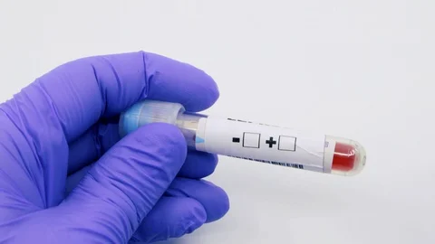 Closeup of microbiologist or medical worker hand with blue surgical gloves ma Stock Footage 129928131