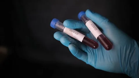 Closeup of microbiologist or medical worker hands with blue surgical gloves look Stock Footage 166823746