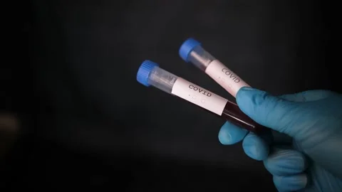 Closeup of microbiologist or medical worker hands with blue surgical gloves look Stock Footage 166823862
