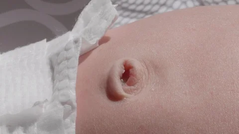 Closeup of a Newborns Belly Button 스톡 동영상 92972953