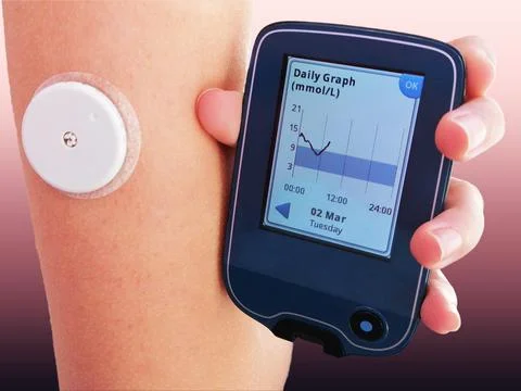 Closeup od device for continuous glucose monitoring in blood – CGM. Stock Photos
