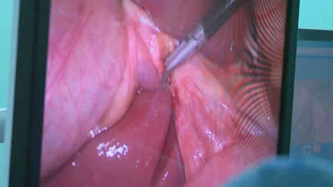 Closeup the Operation screen Stock Footage 129496886