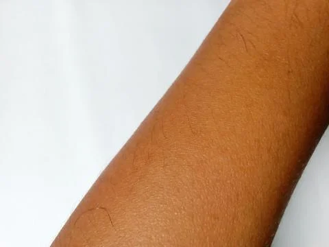 Closeup of a person's arm Foto stock