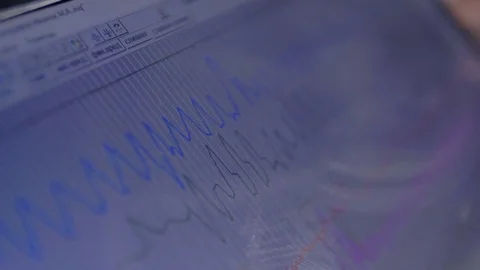 Closeup of a polygraph data laptop screen. Stock Footage 78296664