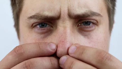 Closeup portrait young man looking at the camera, squeezing acne or blackheads o Stock Footage 89766728