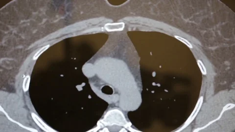 Closeup of the screen of the device for computer tomography Video stock 70793161