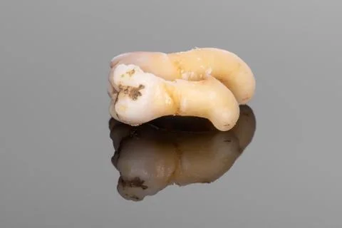 A closeup of a sectioning right lower third molar with curved root Stock Photos