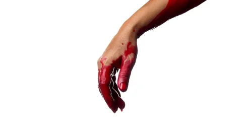 Close up bloody arm hand hi-res stock photography and images - Alamy