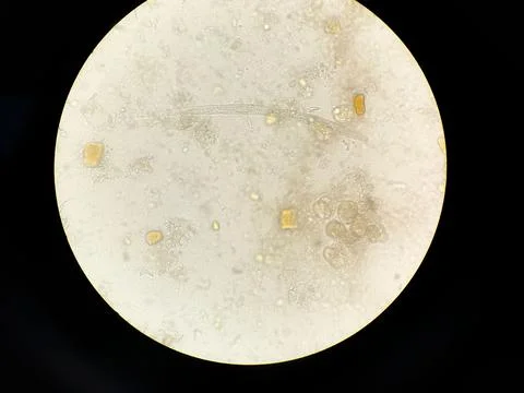 Closeup shot of a parasite 스톡 사진