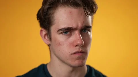 Closeup slow motion of sick tired headache migraine exhausted displeased young Stock Footage 221841247