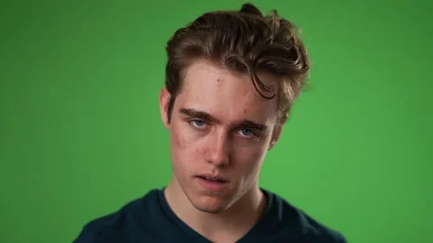 Closeup slow motion of sick tired headache migraine exhausted displeased young Stock Footage 223263456
