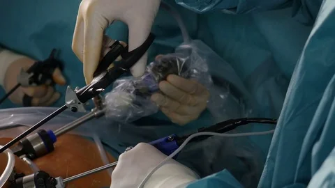 Closeup of surgeon hands during laparoscopic operation, Full HD footage Stock Footage 74148663