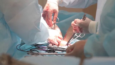 Closeup of surgeon's hand wearing rubber gloves which makes the operation Stock Footage 70807594