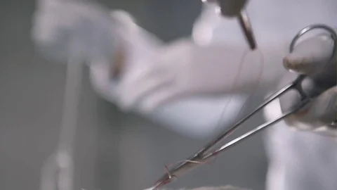 Closeup of surgical teamwork Stock Footage 74370794