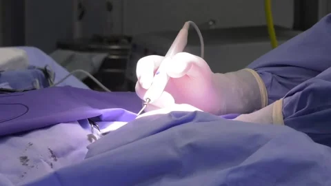 Closeup of surgical teamwork Video stock 120936716