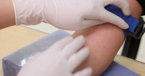 Closeup of taking blood sampling Stock Footage 129504167