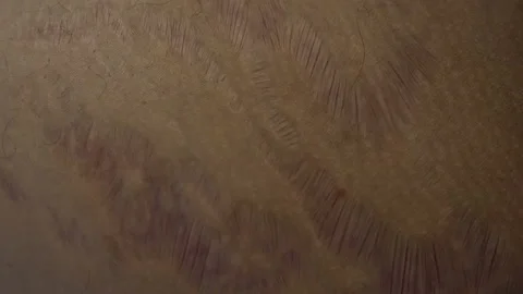 Closeup of terrible skin scars. Marks from bad accident, surgery or from horribl Stock Footage 142504969