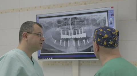 Closeup of two doctors with x-ray prints Stock Footage 61378415