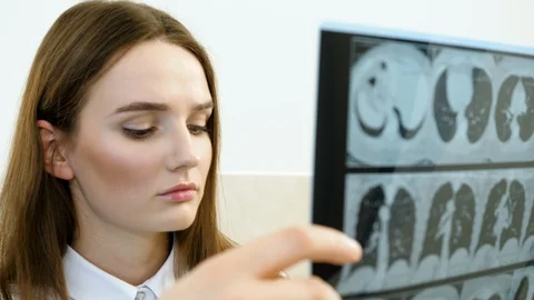 Closeup of two young doctors looking at x-ray scan of lungs in modern clinic. 4K Vídeos de archivo 123211058