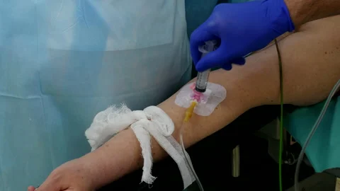Closeup of using iv drip during surgery Video stock 107128233