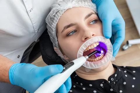Closeup view of dentist using dental curing UV lamp on teeth of patient Foto stock