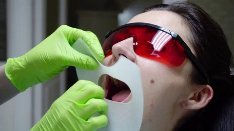 Closeup view of the dentist's hands putting rubber dam in a mouth of a female Stock Footage 74675923