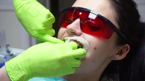 Closeup view of the dentist's hands putting rubber dam in a mouth of a female Stock Footage 74676507