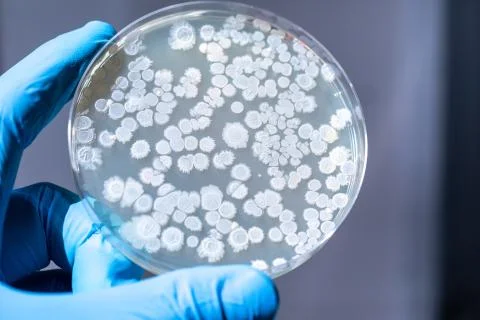A closeup view of microorganisms cultivated inside an agar dish isolated, hel 스톡 사진