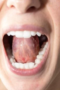 Closeup view on the underside of a tongue inside a womans mouth Stock-Fotos