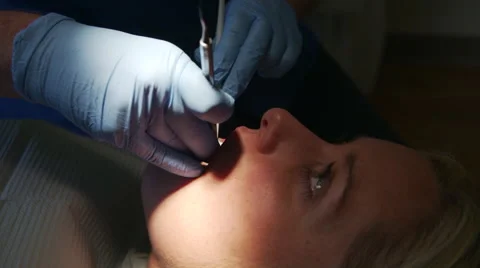 Closeup of Woman Getting Teeth Cleaned at the Dentist Video stock 43309171