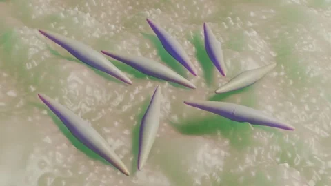 Closterium desmid Stock Footage 305632369