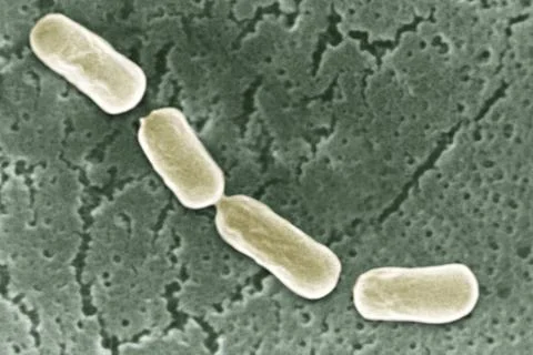 Clostridium botulinum A SEM view: scanning electron microscopy.X15000 Copy... Stock Photos