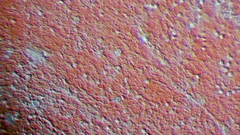 Clotting Blood under a Microscope Video stock 162521431