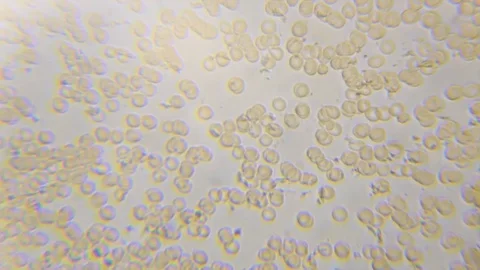 Clotting / Coagulation process of the human blood Video stock 93854884